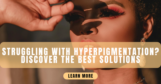 Struggling with Hyperpigmentation? Discover the Best Solutions