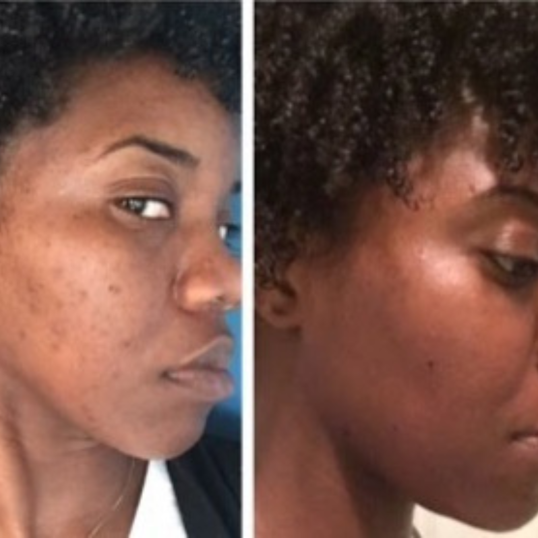 Hembes turmeric skincare products. How to clear skin. Turmeric Skincare. Face wash gel. Face wash. Soap. Turmeric soap. Turmeric. Vitamin c face wash . Face wash. Turmeric face wash gel. Natural skincare products. How to treat acne. How to get rid of dark spots. Dark spots. Acne spots. Pimples. Skincare routine. Glowing skin. Healthy skin. Sensitive skin. Reduce fine lines. Reduce wrinkles. Even skin. Hydrate skin. Nourish skin. Dry skin. Oily skin. Combination skin. Anti-aging skincare