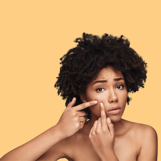 Hembes turmeric skincare products. How to clear skin. Turmeric Skincare. Turmeric clay face mask. Turmeric soap. Turmeric mask. Natural skincare products. Black skin. How to treat acne. How to get rid of black spots. Dark spots. Acne spots. Pimples. Zits