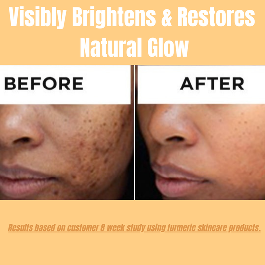 Hembes turmeric skincare products. How to clear skin. Turmeric Skincare. Full skincare set. Skincare routine set. Skincare collection. Face moisturizer. Face wash. Turmeric serum. face cream.Natural skincare products. How to treat acne. How to get rid of dark spots. Dark spots. Acne spots. Pimples. Skincare routine. Glowing skin. Healthy skin. Sensitive skin. Reduce fine lines. Reduce wrinkles. Even skin. Hydrate skin. Nourish skin. Dry skin. Oily skin. Combination skin. Anti-aging skincare