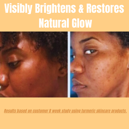 turmeric kojic acid soap. fades dark spots. fades hyperpigmentaion