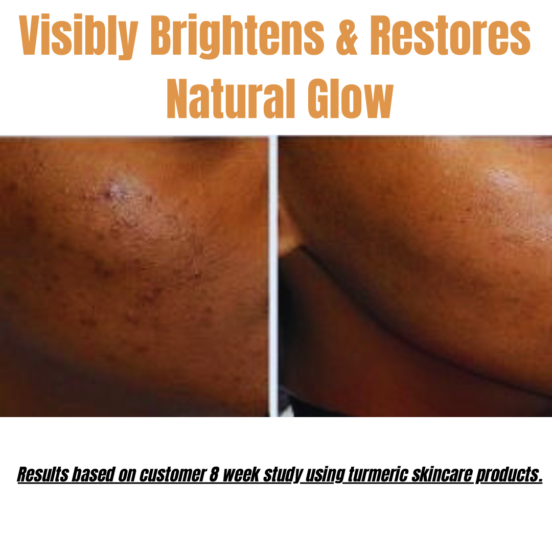 Kojic acid soap. Turmeric kojic acid soap. Hembes skincare. Soap to clear skin. Soap for sensitive skin. Dark spot corrector. turmeric soap. turmeric Kojic acid soap. hyperpigmentation