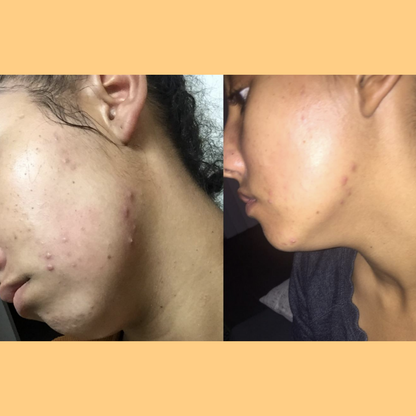 Hembes turmeric skincare products. How to clear skin. Turmeric Skincare. Face wash gel. Face wash. Soap. Turmeric soap. Turmeric. Vitamin c face wash . Face wash. Turmeric face wash gel. Natural skincare products. How to treat acne. How to get rid of dark spots. Dark spots. Acne spots. Pimples. Skincare routine. Glowing skin. Healthy skin. Sensitive skin. Reduce fine lines. Reduce wrinkles. Even skin. Hydrate skin. Nourish skin. Dry skin. Oily skin. Combination skin. Anti-aging skincare