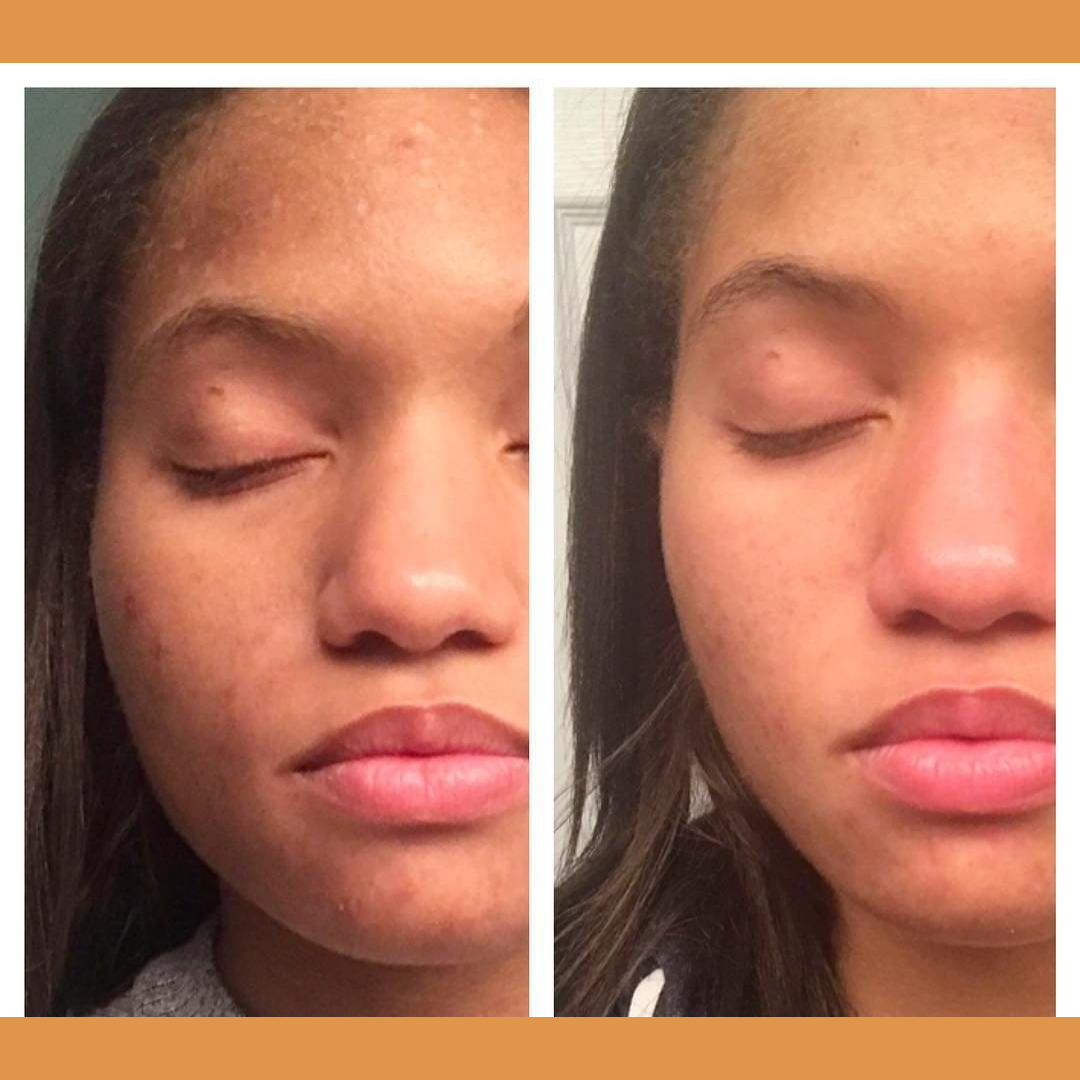 Hembes turmeric skincare products. How to clear skin. Turmeric Skincare. Face wash gel. Face wash. Soap. Turmeric soap. Turmeric. Vitamin c face wash . Face wash. Turmeric face wash gel. Natural skincare products. How to treat acne. How to get rid of dark spots. Dark spots. Acne spots. Pimples. Skincare routine. Glowing skin. Healthy skin. Sensitive skin. Reduce fine lines. Reduce wrinkles. Even skin. Hydrate skin. Nourish skin. Dry skin. Oily skin. Combination skin. Anti-aging skincare