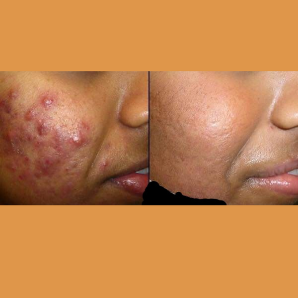 We're Loved By Thousands For A Reason: Our Products Truly Delivers Results!